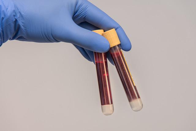 Beyond the Blood Draw: Causes of a Hemolytic Sample
