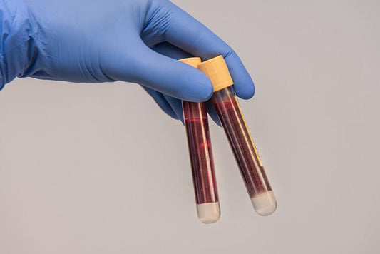Beyond the Blood Draw: Causes of a Hemolytic Sample